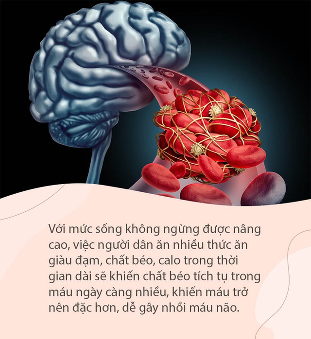 Khi mạch máu não bị tắc nghẽn, sẽ có 4 biểu hiện này ở bàn chân, chú ý để phòng tránh đột quỵ bất ngờ - Ảnh 1.