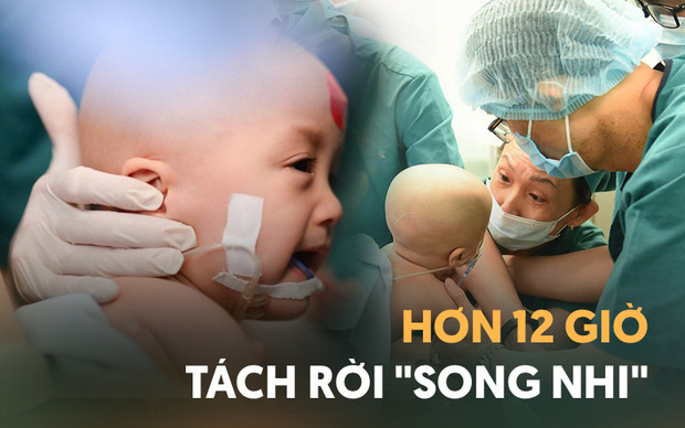Cặp song sinh Trúc Nhi - Diệu Nhi đã tỉnh lại sau ca mổ hơn 12 tiếng, đang được chăm sóc tích cực - Ảnh 3.