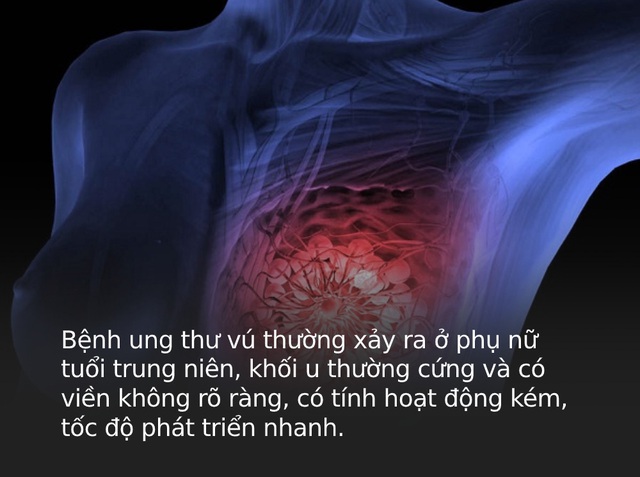 4 loại ung thư dễ chẩn đoán sai nhất, có thể chỉ khác nhau ở một chi tiết cực kỳ nhỏ - Ảnh 3.