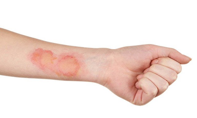 5 dấu hiệu cảnh báo đường huyết đã cao vượt mức, tiểu đường rình rập: Người trẻ thường xuyên thức khuya, ăn ngon tuyệt đối đừng chủ quan - Ảnh 4.