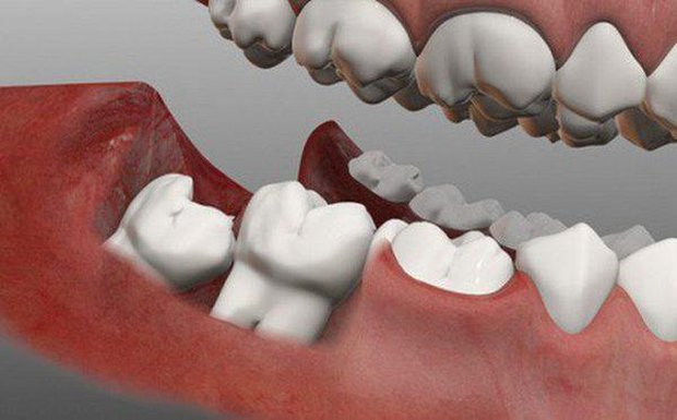 Vì sao con người chỉ có duy nhất 1 lần thay răng suốt cuộc đời? - Ảnh 2.