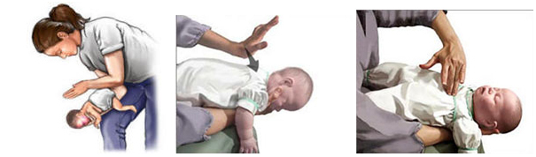 Lại một trẻ tử vong vì hóc thạch: Cơ hội duy nhất chỉ 4-5 phút, bố mẹ cần làm gì cứu con? - Ảnh 1.