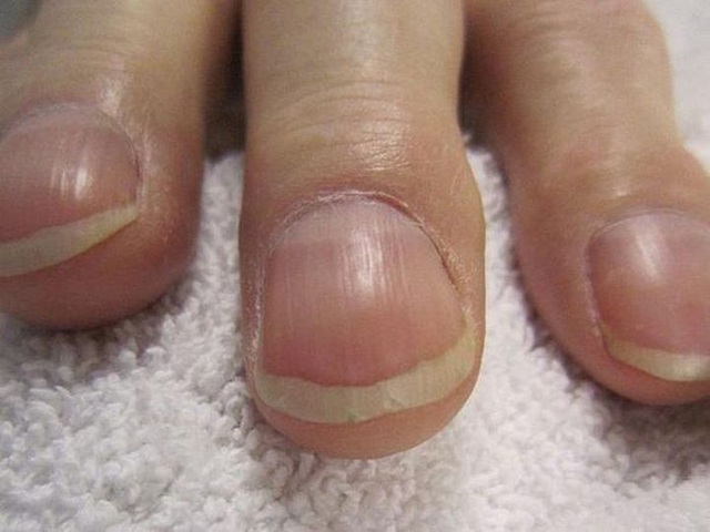 Cơ thể xuất hiện 1 đen, 2 lồi, 3 đau cảnh báo phổi bị tổn thương - Ảnh 2.