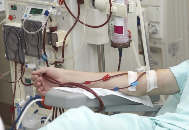 Chàng trai mới 22 tuổi đã phải chạy thận cả đời, bác sĩ cảnh báo 2 thói quen của giới trẻ nếu không bỏ sớm thì sẽ sinh bệnh - Ảnh 3.
