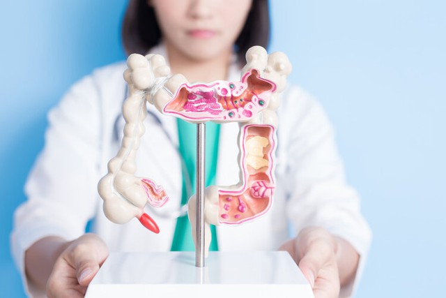 Một loại rau được mệnh danh là rau hoàng đế: Chứa vô số chất dinh dưỡng lại khá ít calo, ăn mỗi ngày giúp giảm 50% nguy cơ ung thư ruột kết - Ảnh 4.
