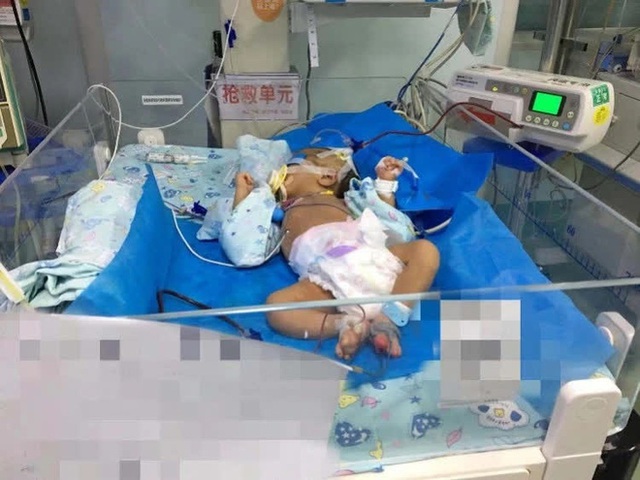 Bé trai 1 tháng tuổi bị xuất huyết não, bác sĩ cảnh báo thói quen ăn uống của mẹ có thể ảnh hưởng nghiêm trọng đến con - Ảnh 2.