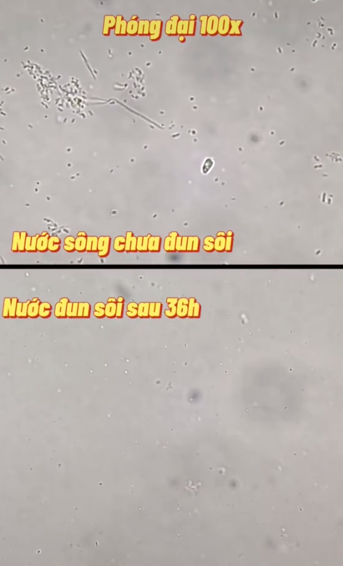 SỰ THẬT rùng mình về nước sôi để nguội khi soi dưới kính hiển vi và 3 loại nước lọc không nên uống để tránh nhiễm độc, mắc ung thư - Ảnh 2.