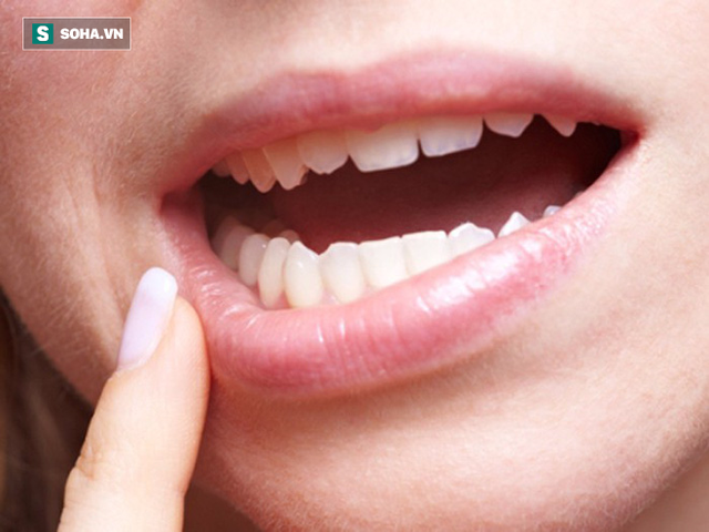 10 hậu quả của việc không uống đủ nước khiến bạn giật mình: 5 mẹo để uống nhiều nước hơn - Ảnh 2.