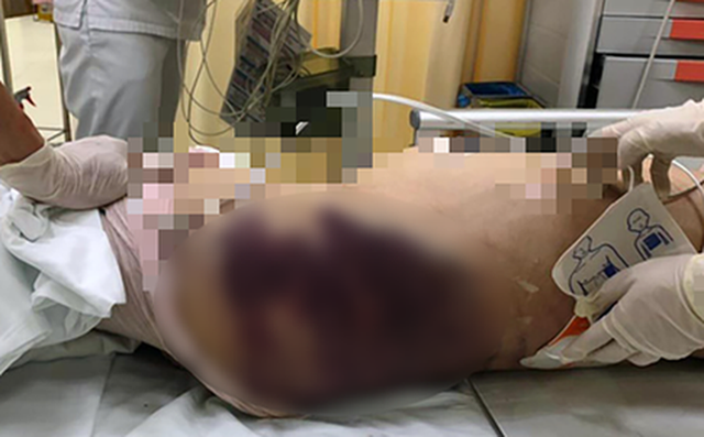 Vụ bé gái 8 tuổi ở TP.HCM: Đủ cơ sở để khởi tố mẹ kế tội giết người, bố bé xóa dữ liệu camera được coi là đồng phạm? - Ảnh 4.