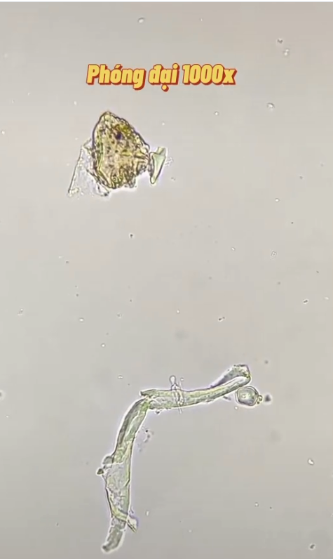 Chuyên gia nói gì về clip sự thật khi soi nước mắm dưới kính hiển vi và 4 lưu ý khi người Việt dùng nước mắm để không ảnh hưởng sức khỏe - Ảnh 2.