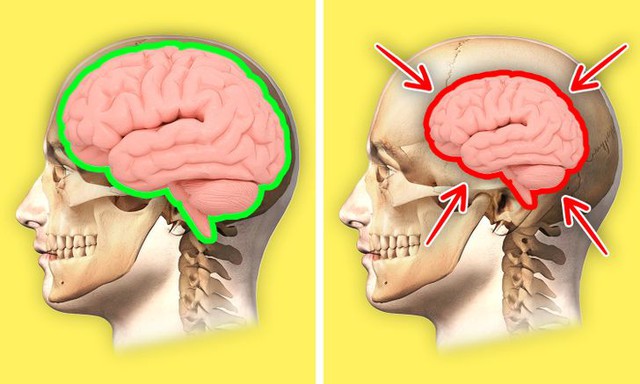 Thiếu ngủ gây hại cho sức khỏe hơn bạn tưởng: Béo phì, nhanh già, thậm chí teo não - Ảnh 3.