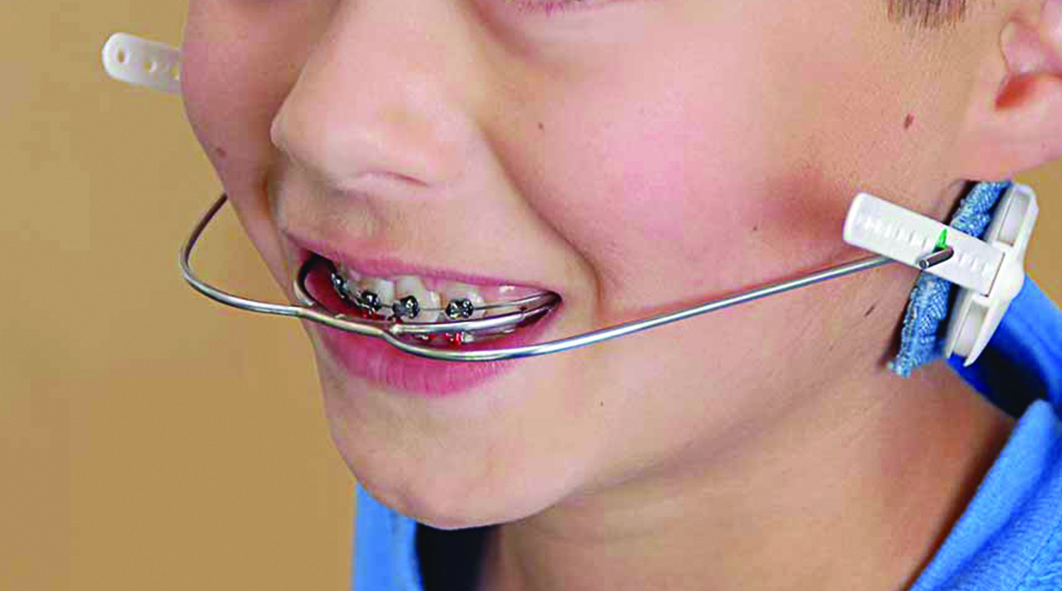 Headgear - CXC Dental