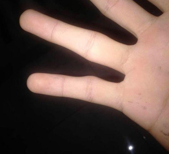 Người dùng điện thoại thường xuyên rất dễ gặp 7 kiểu chấn thương này: Đau khớp, hại mắt, ảnh hưởng không nhẹ tới cột sống - Ảnh 2.