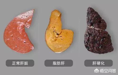 Nếu cơ thể có 4 chỗ luôn CỨNG, đó là dấu hiệu cảnh báo bạn sẽ có tuổi thọ ngắn hơn nhiều người khác! - Ảnh 4.