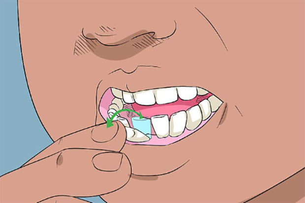 6 dấu hiệu điển hình cảnh báo nguy cơ lão hóa răng sớm mà nhiều người chẳng ngờ đến - Ảnh 3.