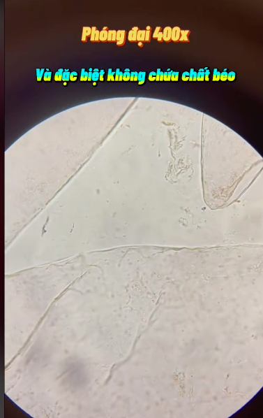 Kết quả bất ngờ khi soi quả mận dưới kính hiển vi và 5 đối tượng dù thèm cũng không nên ăn mận kẻo rước bệnh vào người - Ảnh 3.