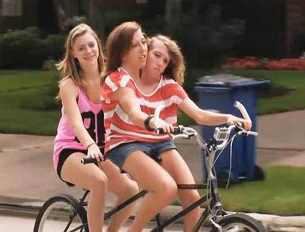 Bị chẩn đoán khó sống sót, cặp chị em sinh đôi dính liền chỉ có 2 chân khiến thế giới kinh ngạc với cuộc sống và diện mạo sau hơn 30 năm - Ảnh 10.