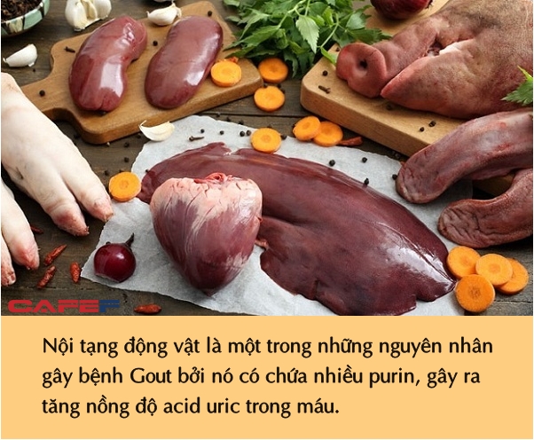 3 món quen thuộc người Việt thường xuyên ăn, đáng sợ không kém gì rượu bia, làm cho axit uric máu tăng vọt - Ảnh 2.