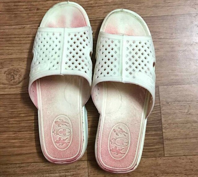 Mồ hôi máu - hiện tượng kỳ lạ chỉ 1/10.000.000 người mắc phải: Những người bị lo lắng và căng thẳng vì làm việc quá sức càng cần chú ý - Ảnh 1.