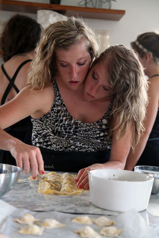 Bị chẩn đoán khó sống sót, cặp chị em sinh đôi dính liền chỉ có 2 chân khiến thế giới kinh ngạc với cuộc sống và diện mạo sau hơn 30 năm - Ảnh 8.