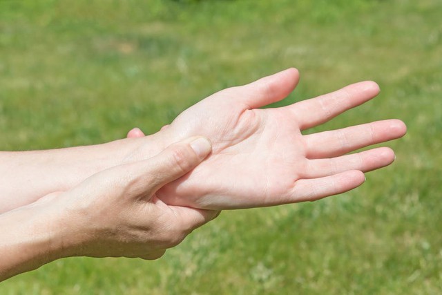 3 dấu hiệu ở bàn tay là lời “cầu cứu” của tim mạch: bác sĩ kiến nghị đi kiểm khám ngay khi tay có 3 biểu hiện sau, nguy cơ nhiều bệnh tật đang “kéo đến” - Ảnh 3.