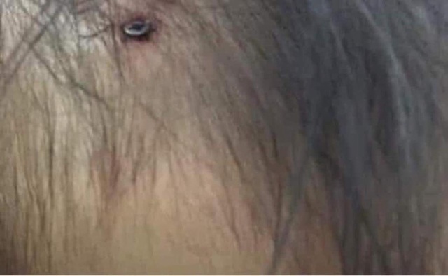 Xuất hiện hình ảnh nghi là bé gái 3 tuổi ở Hà Nội với chiếc đinh lớn cắm thẳng vào đầu khiến dân mạng dậy sóng - Ảnh 1.